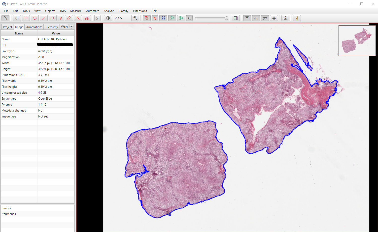 Read QuPath annotation exported in GeoJSON in Python - Development -  Image.sc Forum