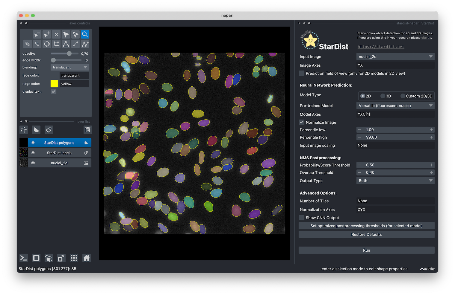 Stardist 3D Training Error with Original Config Values - Usage & Issues -  Image.sc Forum