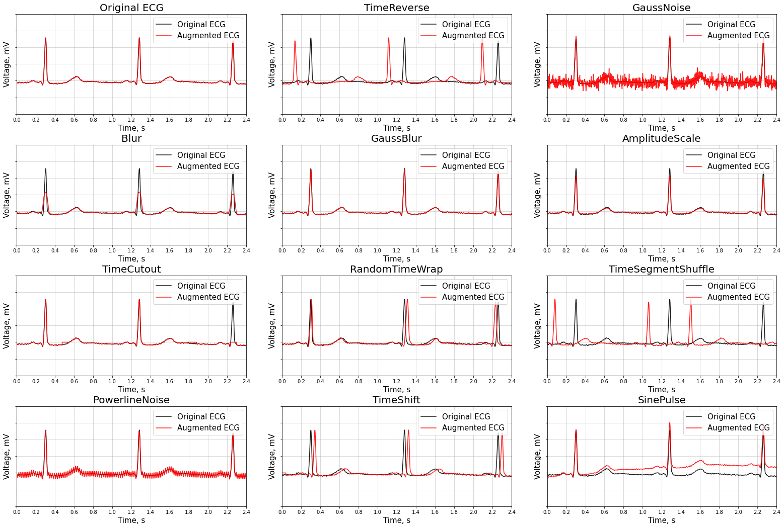 Ecgmentations pypi